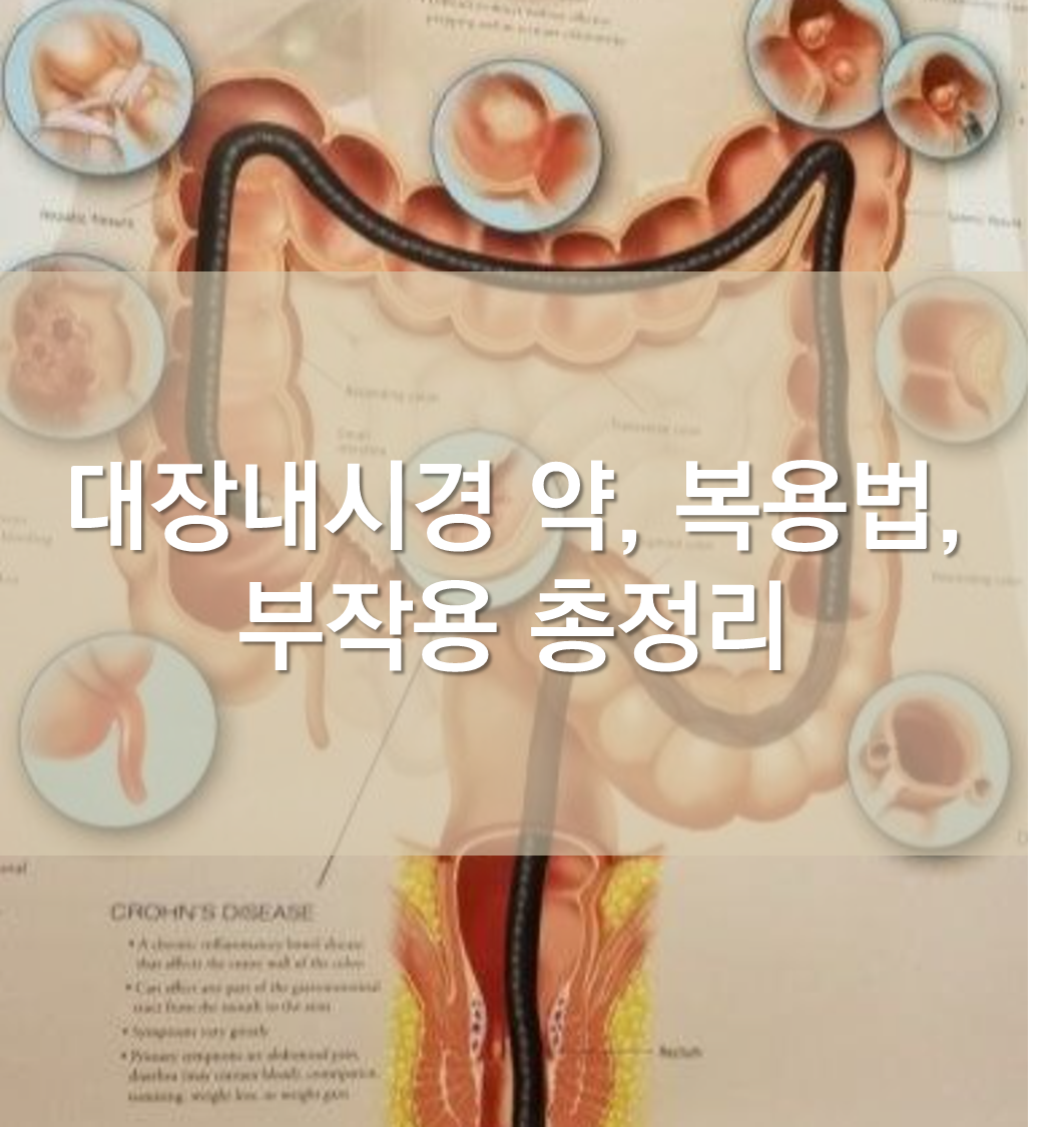 대장내시경 검사